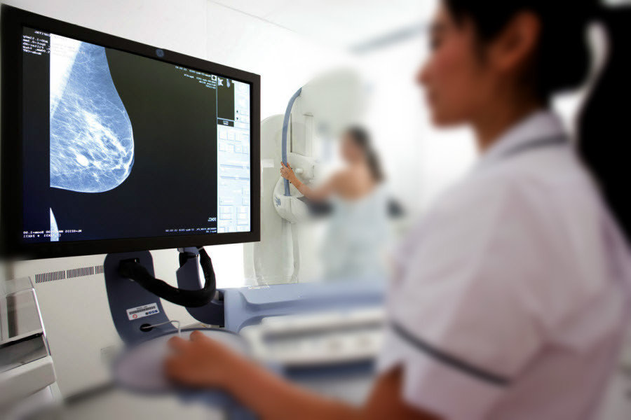 乳腺癌检查 乳腺癌检查