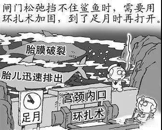 宫颈机能不全环扎术图解