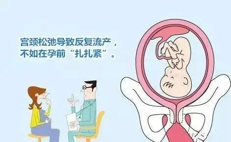 宫颈机能不全怎么办呢