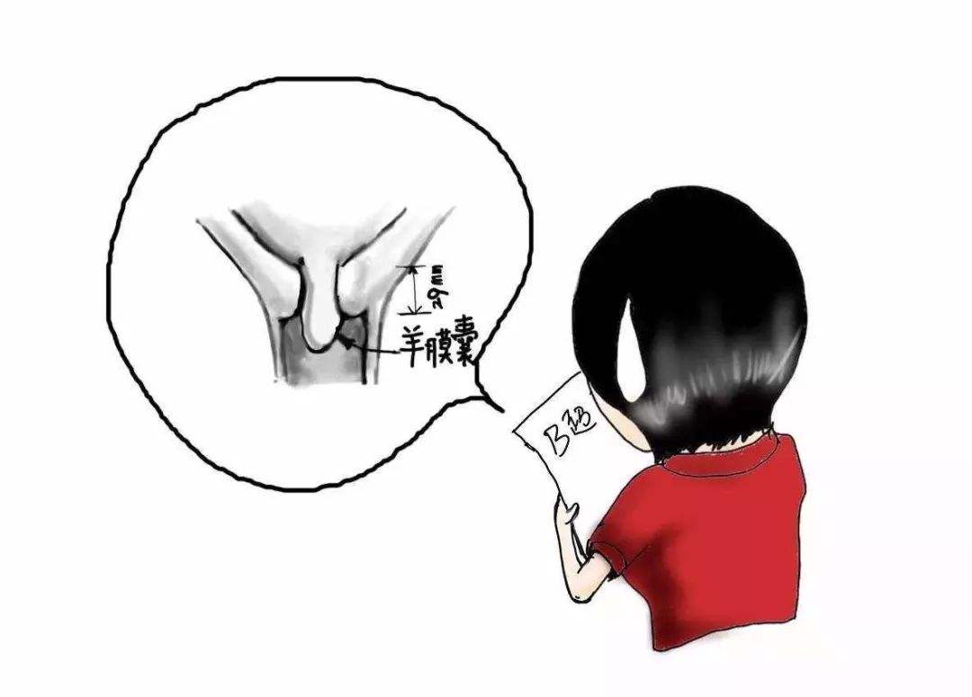 什么是宫颈机能不全