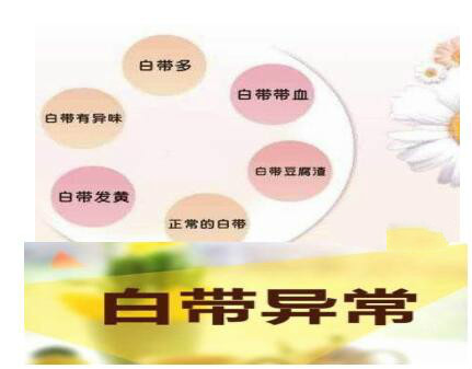 白带长期异常