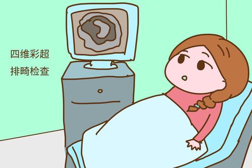 四维彩超排畸检查
